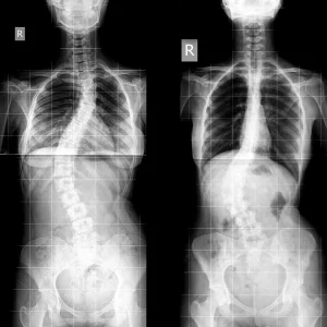 COLUMNA COMPLETA 2PROYECCIONES