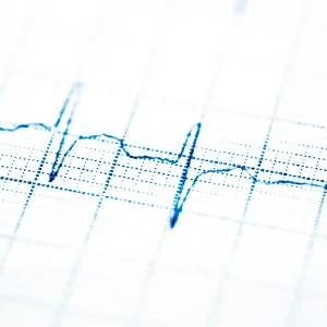 Electrocardiograma