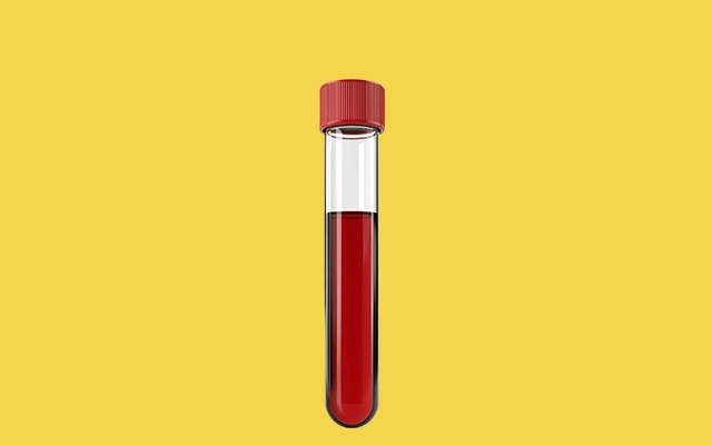 Hematologia
