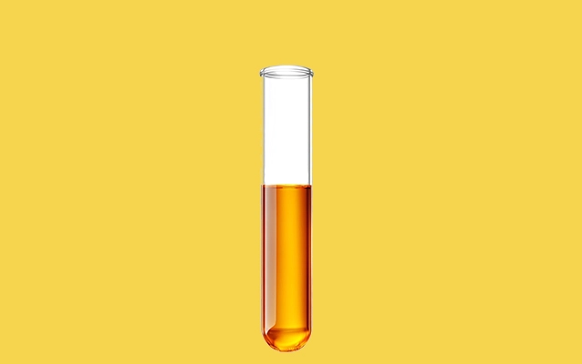 Uroanalisis