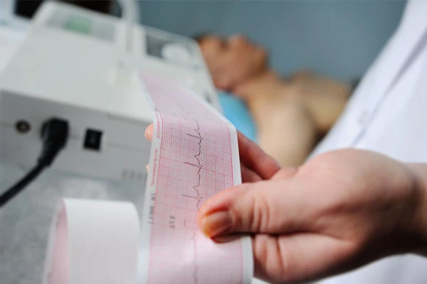 Electrocardiograma en reposo