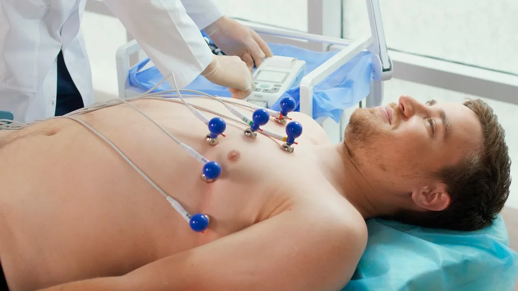Electrocardiograma