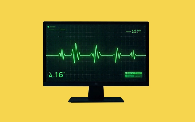 Electrocardiograma
